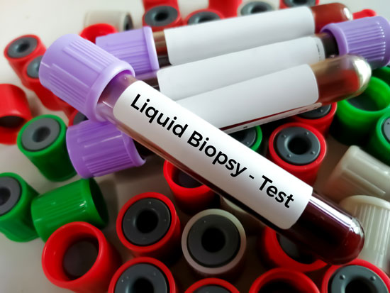 Blood vials for liquid biopsy